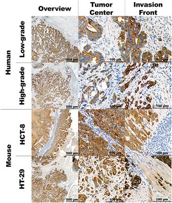 Cell Line Derived Xenograft Mouse Models Are a Suitable in vivo Model for Studying Tumor Budding in Colorectal Cancer